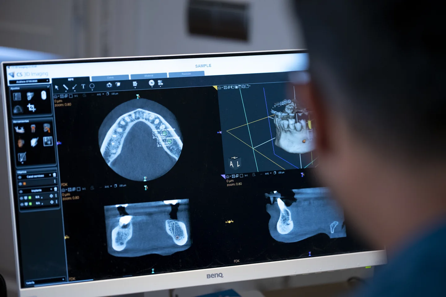 Imatges tridimensionals de les estructures dentals en una pantalla a Lleida