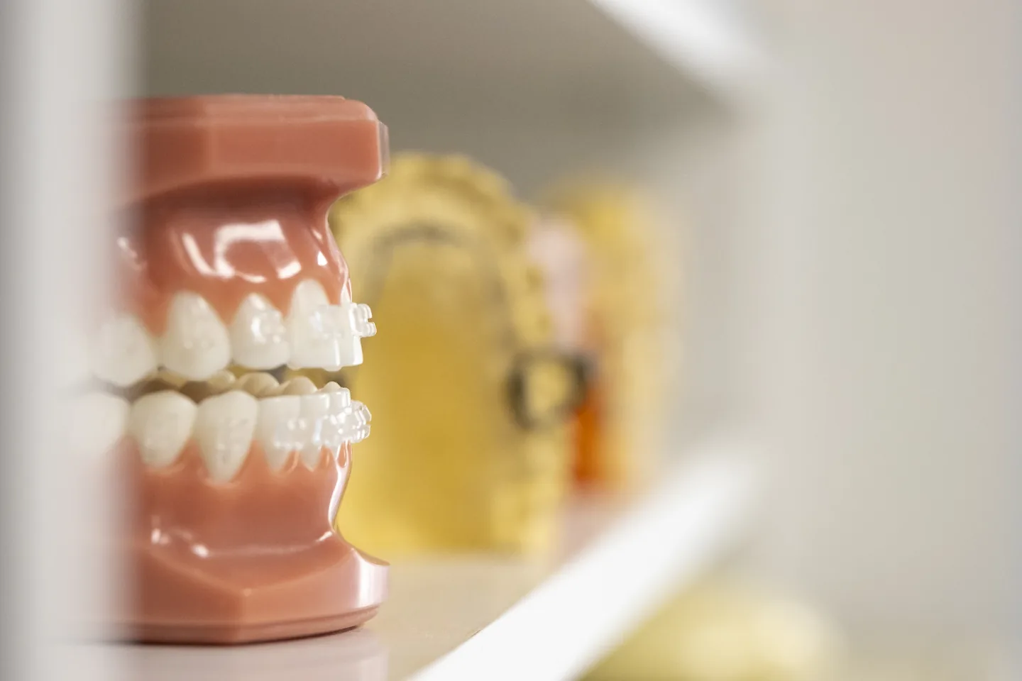 Model de dents amb bràquets a la clínica de Lleida